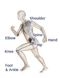 Myofascial Pain – Orthopedic Specialists 